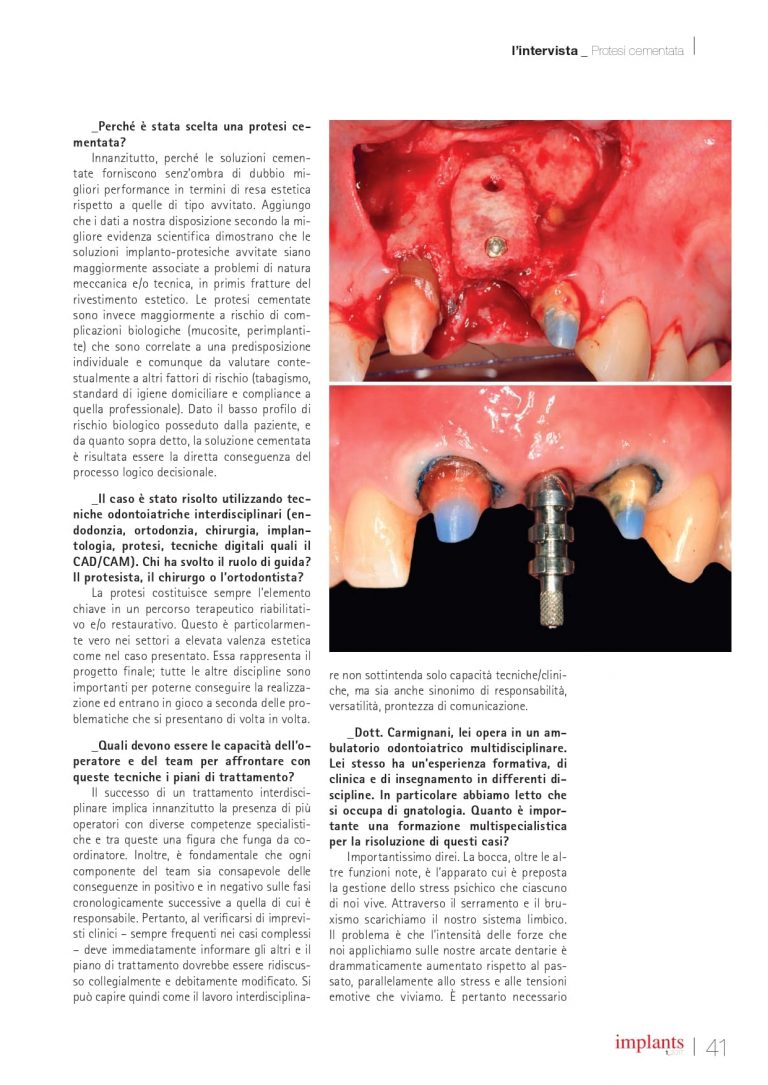 PEERS2016_Implants012017-3_page-0006